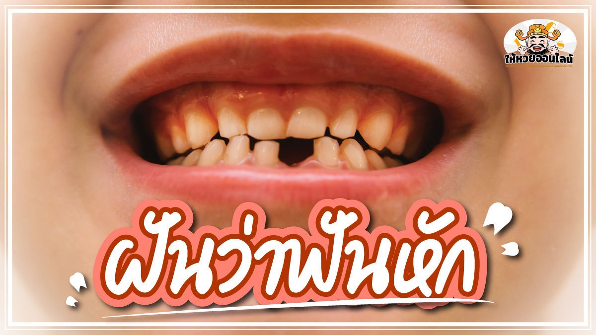 image-ลางบอกข่าวร้าย ฝันว่าฟันหัก ทำนายฝันพร้อมเลขเด็ดนำโชค