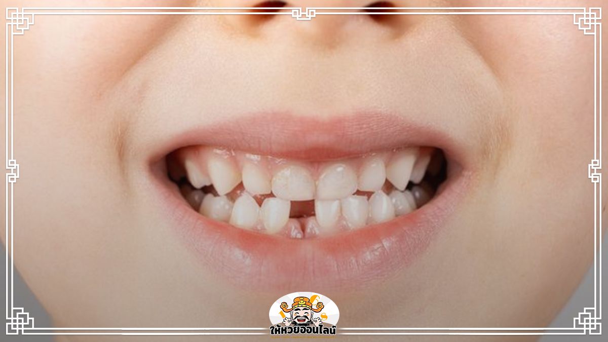 image-ฝันว่าฟันหลุด ฟันหัก เขาว่าจะมีเรื่องร้าย ๆ เกิดขึ้นจริงไหม