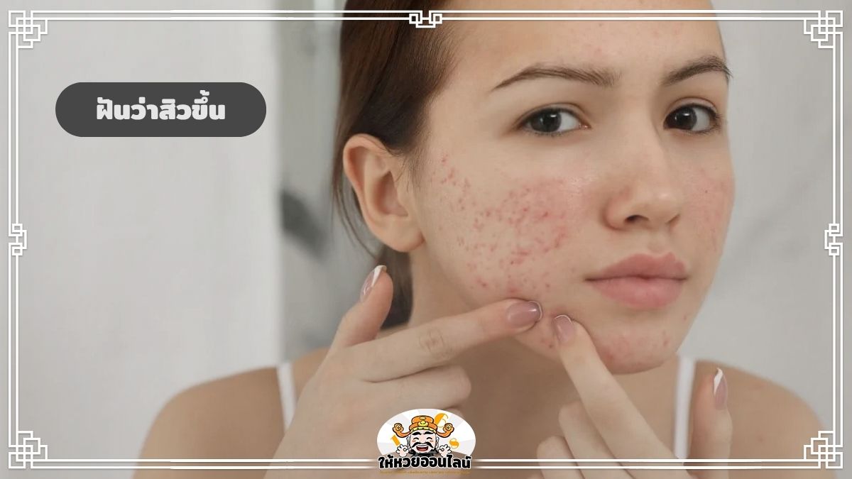image-ฝันว่าสิวขึ้น ฝันว่าเป็นสิว ฝันแบบนี้จะเป็นจริงไหม ทำนายความฝัน