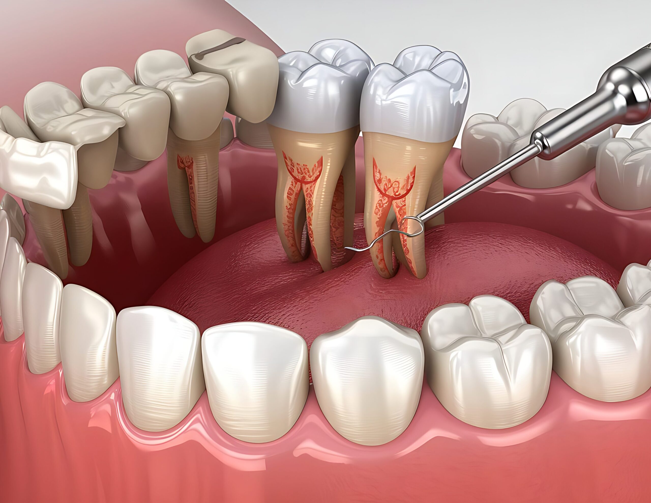 ฟันหลุด
